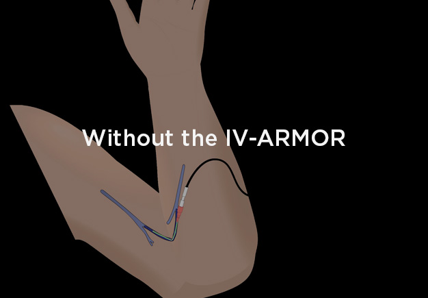 IV-ARMOR® - Dale Medical Products